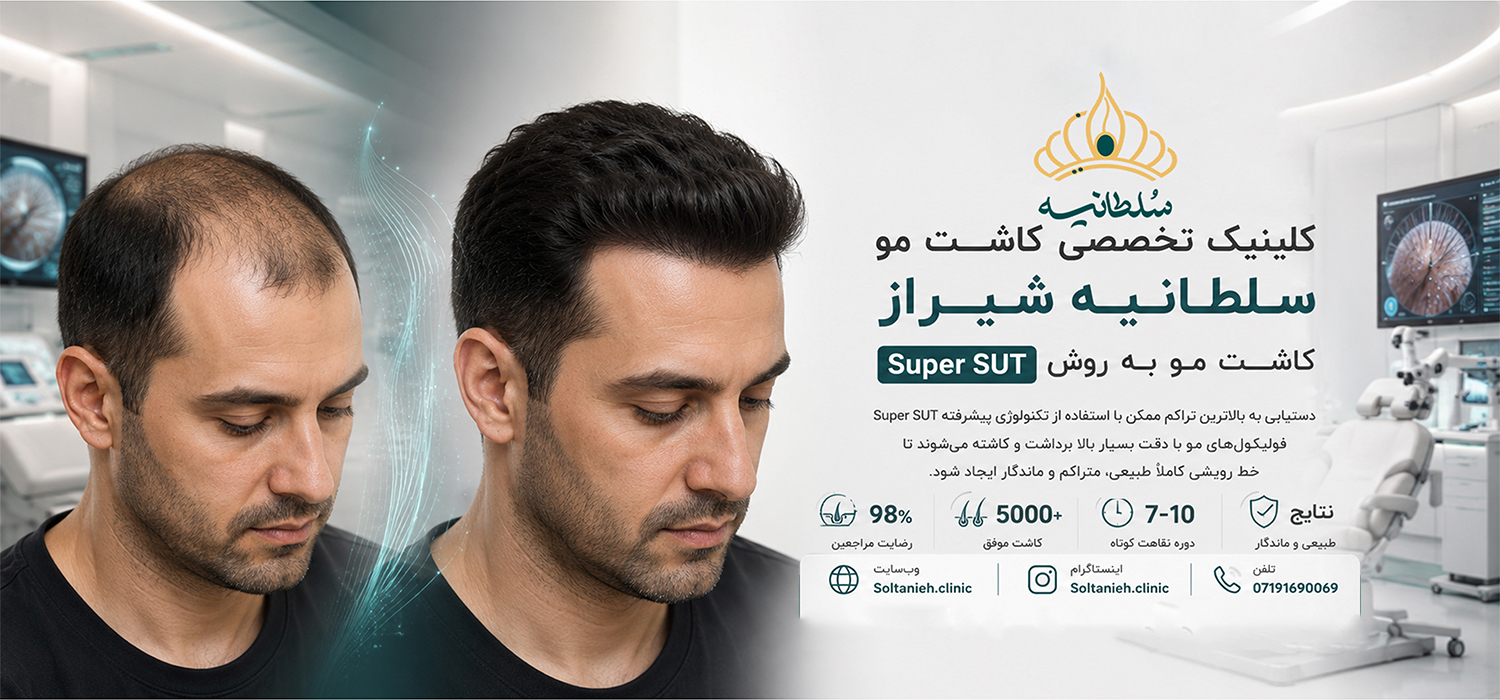 کاشت مو شیراز