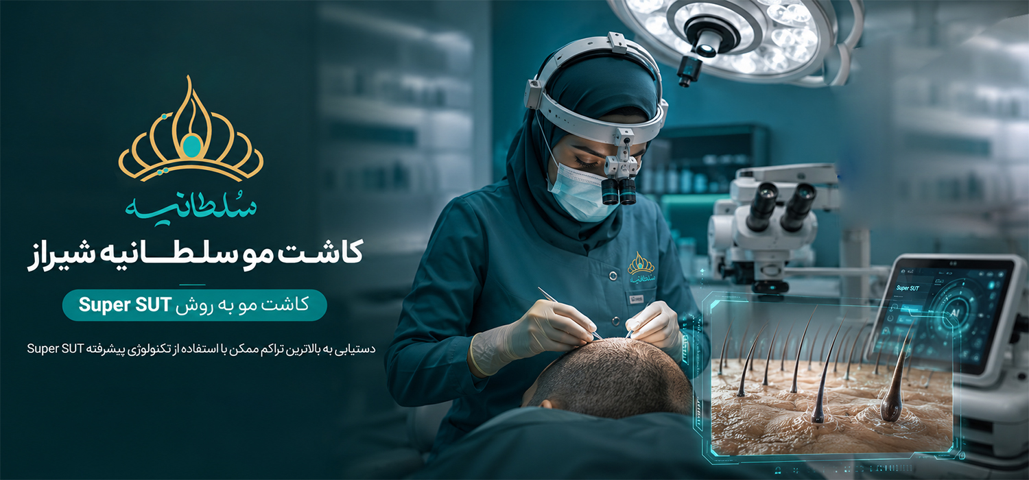معجزه کاشت مو